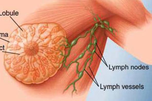 دراسة تفسر العلاقة بين الكولسترين وسرطان الثدى