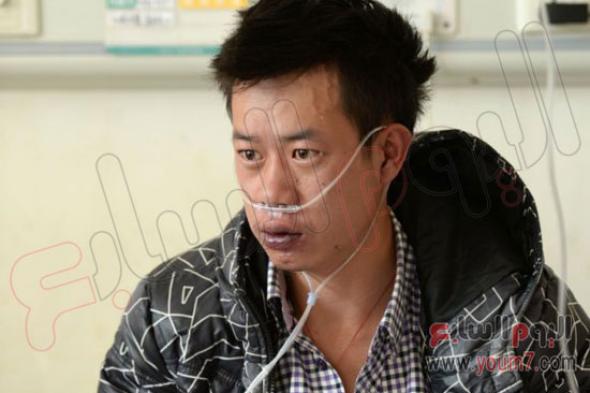 بالصور.. شاب صينى مصاب بمرض نادر يجعل قلبه بارزاً بمنتصف بطنه