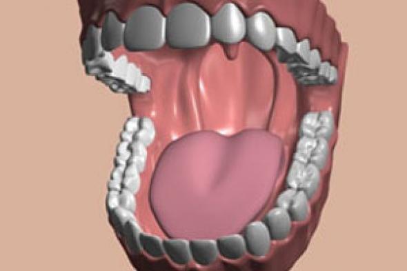 القشرة التجميلية أحدث علاجات الأسنان