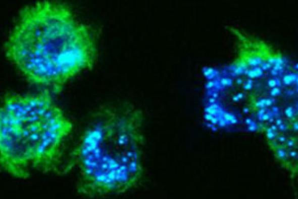 دراسة عقار جديد يعطى الأمل لمرضى سرطان الدم