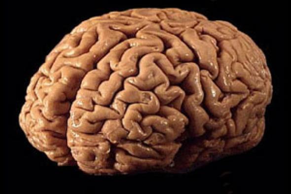 دراسة: الخلل فى مستقبلات المخ هو المسئول عن تشويش الذكريات