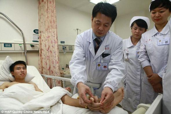 بالصور.. أطباء يعيدون تركيب يد شاب صينى بعد شهر من بترها