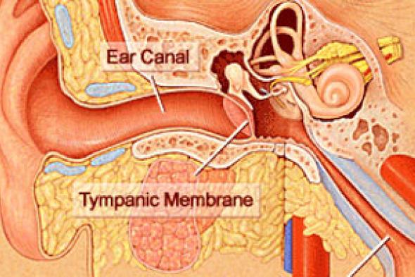 إهمال علاج التهابات الأذن الداخلية يؤدى للإصابة بالصمم