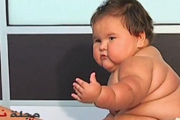 طفلة كولومبية عمرها 10 أشهر يصل وزنها إلى 20 كغ