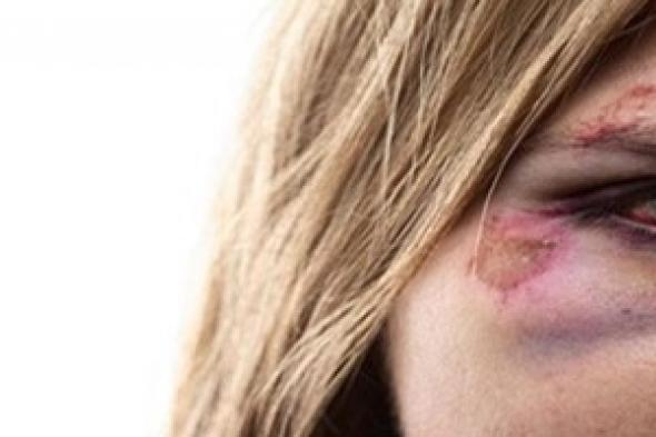 حقوق نساء الدانمارك  مكفولة لكنّ الانتهاكات مستمرّة