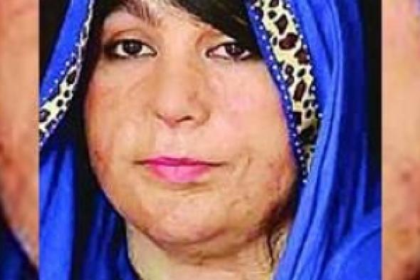ممتاز الأفغانية تعيش وسط خوف دائم بعد تشويه وجهها بالحمض