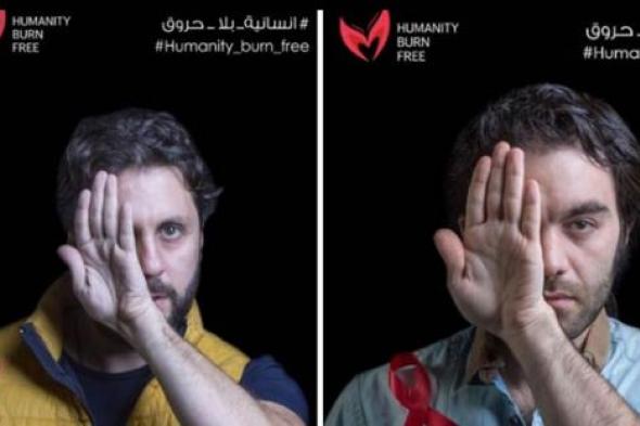 صور-هشام ماجد وشريف رمزي يشاركان في مبادرة "إنسانية بلا حروق"