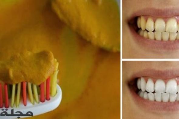 احصل على أسنان بيضاء بشكل فوري بمكون واحد فقط !