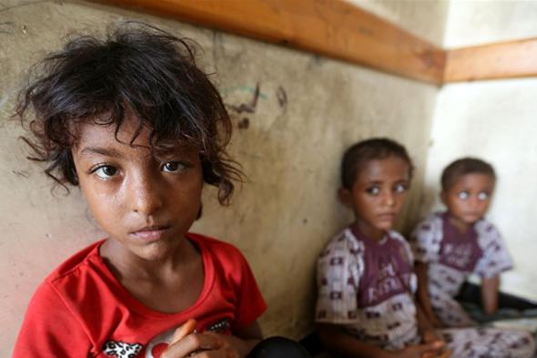 #اليمن.. وفاة 100 ألف طفل سنوياً بسبب الحرب والحصار 
#lebanon24
 via @Lebanon24