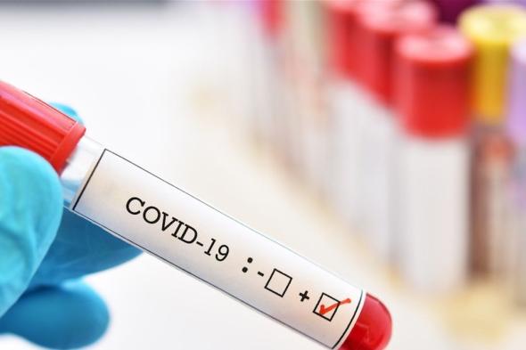 وحدة كوارث قضاء صور: 58 إصابة جديدة لمقيمين مخالطيين 
#lebanon24
 via @Lebanon24