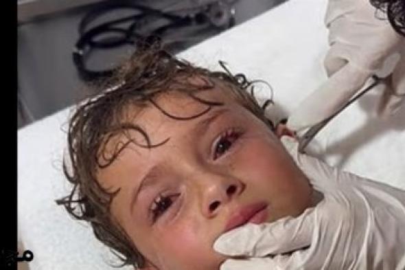 واقعة غريبة جداً.. استخراج سلطعون من أذن طفل (فيديو)